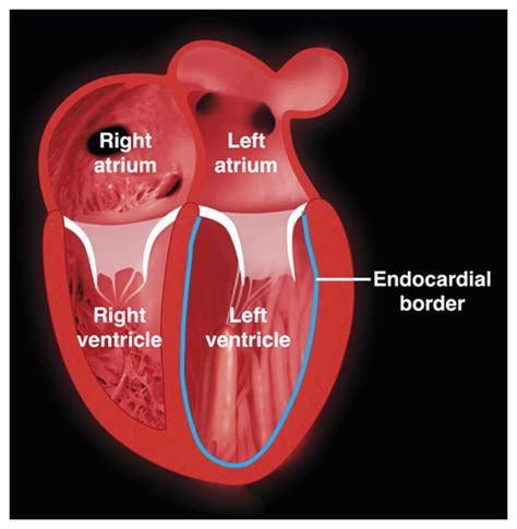 what is lv function|picture of left ventricle heart.